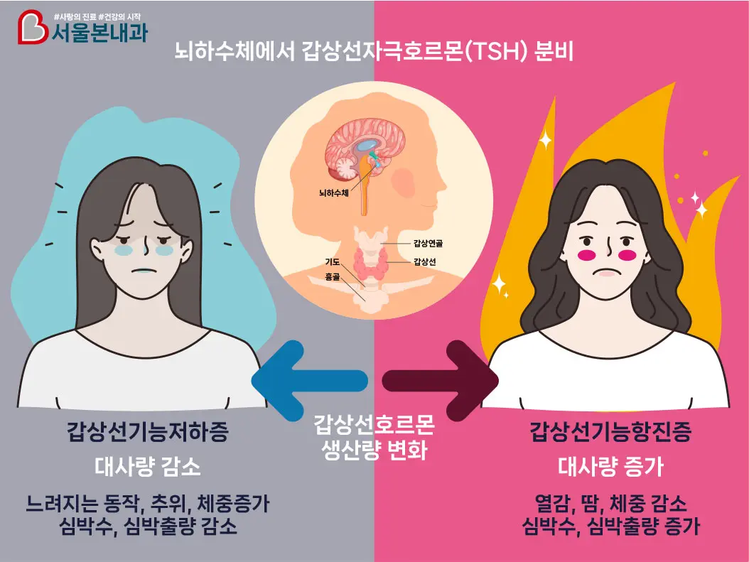 뇌하수체에서 생기는 갑상선 자극호르몬(TSH)의 분비되는데, 갑상선 호르몬 생산량 변화에 따라 갑상선 기능 저하증 또는 갑상선 기능 항진증이 될 수 있습니다