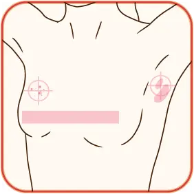 유방암 자가검진 3