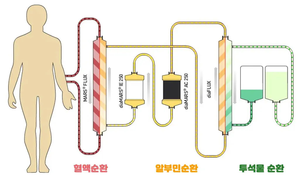 투석기의 작동원리 혈액수환, 알부민순환, 투석물 순환