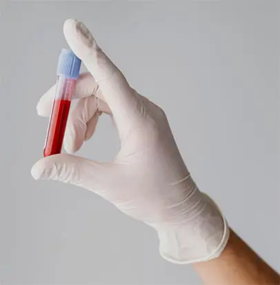 직접 분석하는 혈액검사시스템