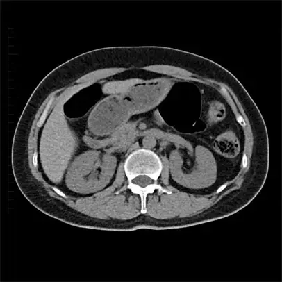영상의학전문의가 직접 운용하는 영상의학검사